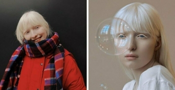 Настя Жидкова: модель-альбинос с нестандартной внешностью (14 фото)