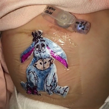 Хирург рисует мультяшек на послеоперационных повязках, чтобы поднять маленьким пациентам настроение (16 фото + 1 видео)